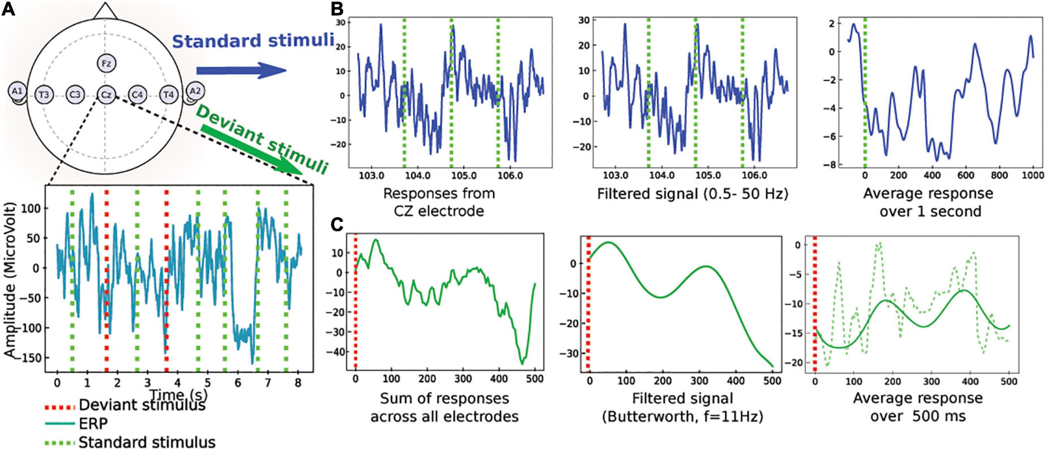 Predicting neurological outcome after cardiac arrest by combining computational parameters extracted from standard and deviant responses from auditory evoked potentials